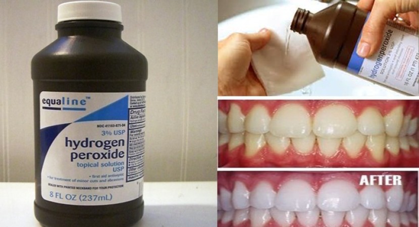 Peroxide guide. Hydrogen Peroxide use. Адьюкас Peroxide. Ресурекшин Peroxide.